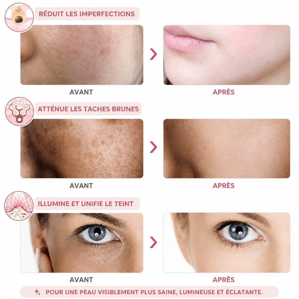 Masque Facial LED